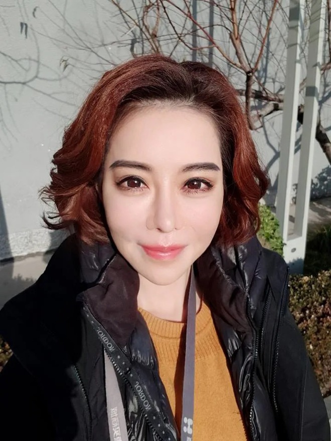 Tình trạng tổn thương răng nghiêm trọng của Tư Dung