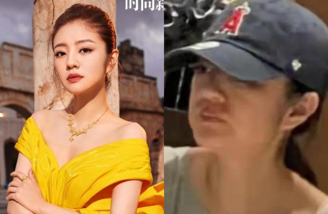 Nữ diễn viên già nua, gương mặt sưng phồng, làn da chảy xệ