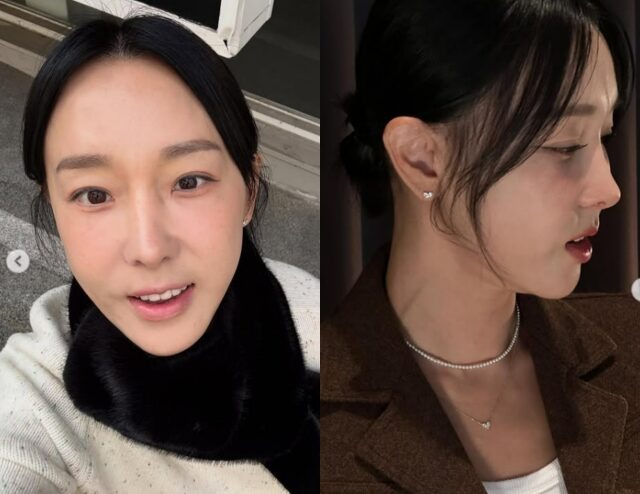 Hình ảnh Lee Ji Hye trước và sau phẫu thuật nhân trung